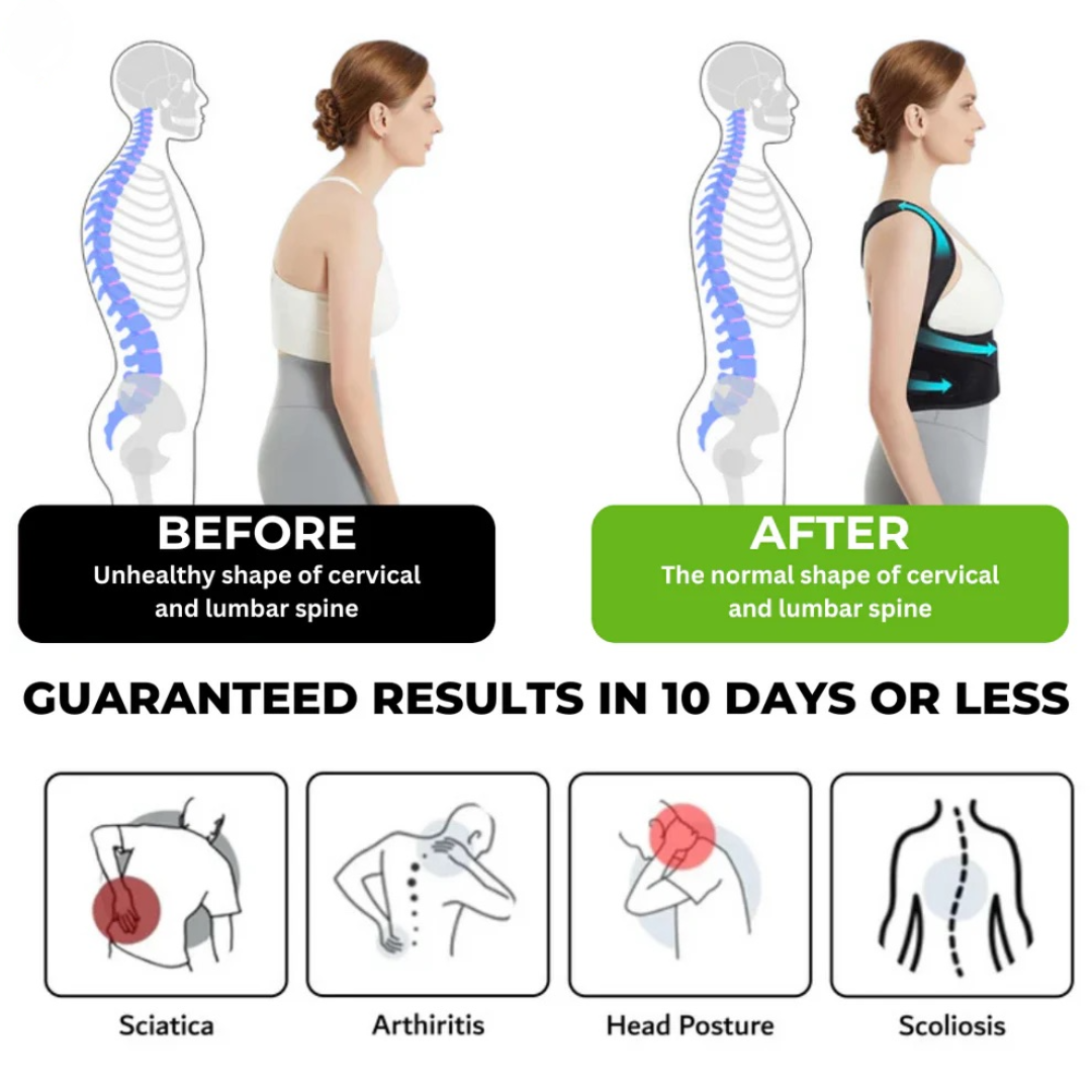 Adjustable Back Posture Corrector Brace